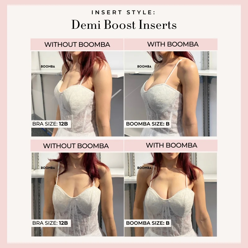 Bridal Bra Kit - Image 10